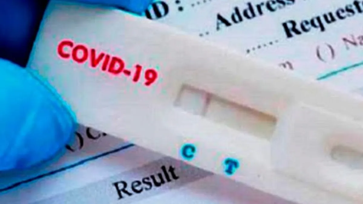 La ANMAT autorizó la venta libre en farmacias de un test rápido de coronavirus