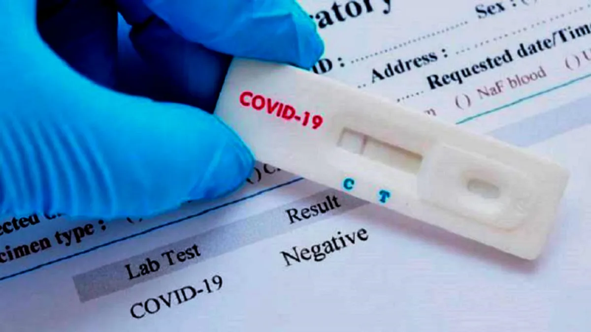 Córdoba no avala la venta libre de test rápido de coronavirus