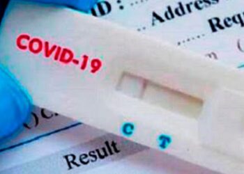 La ANMAT autorizó la venta libre en farmacias de un test rápido de coronavirus