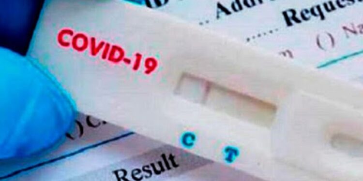 La ANMAT autorizó la venta libre en farmacias de un test rápido de coronavirus