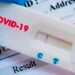 La ANMAT autorizó la venta libre en farmacias de un test rápido de coronavirus