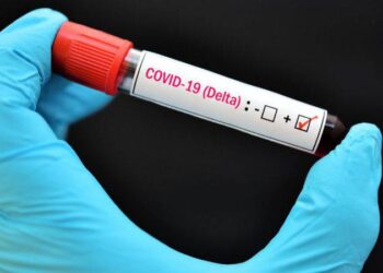 Detectan otros 17 casos de la variante Delta en el país