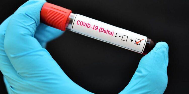 Detectan otros 17 casos de la variante Delta en el país