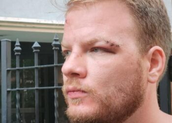 Detuvieron a seis personas por la golpiza a un periodista en un boliche de Carlos Paz