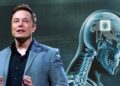 Elon Musk anunció que Neuralink realizó el primer implante cerebral en un ser humano