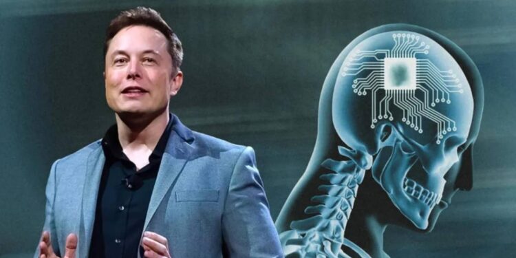 Elon Musk anunció que Neuralink realizó el primer implante cerebral en un ser humano