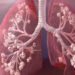 El 8 de septiembre es el Día Mundial de la Fibrosis Quística