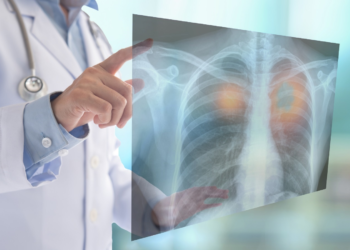 Día Mundial del Cáncer de Pulmón