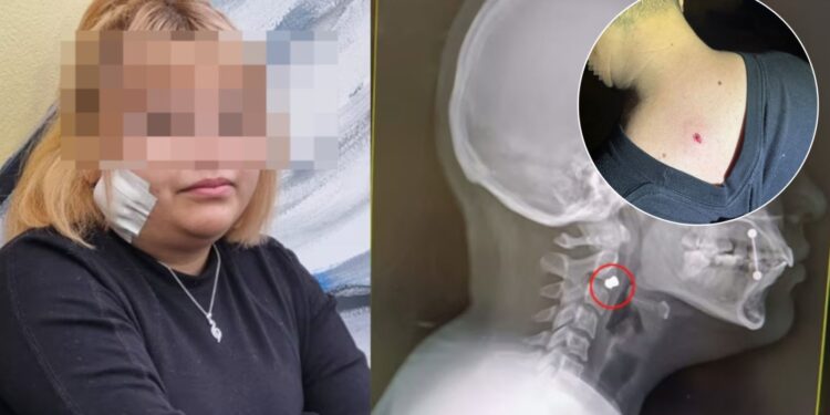 Agravan la acusación contra los jóvenes que dispararon en Plaza España