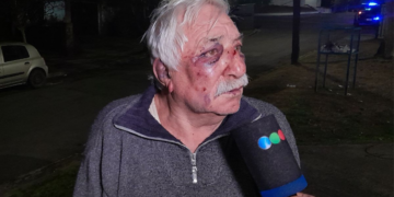 Una pareja de jubilados sufrió un violento asalto